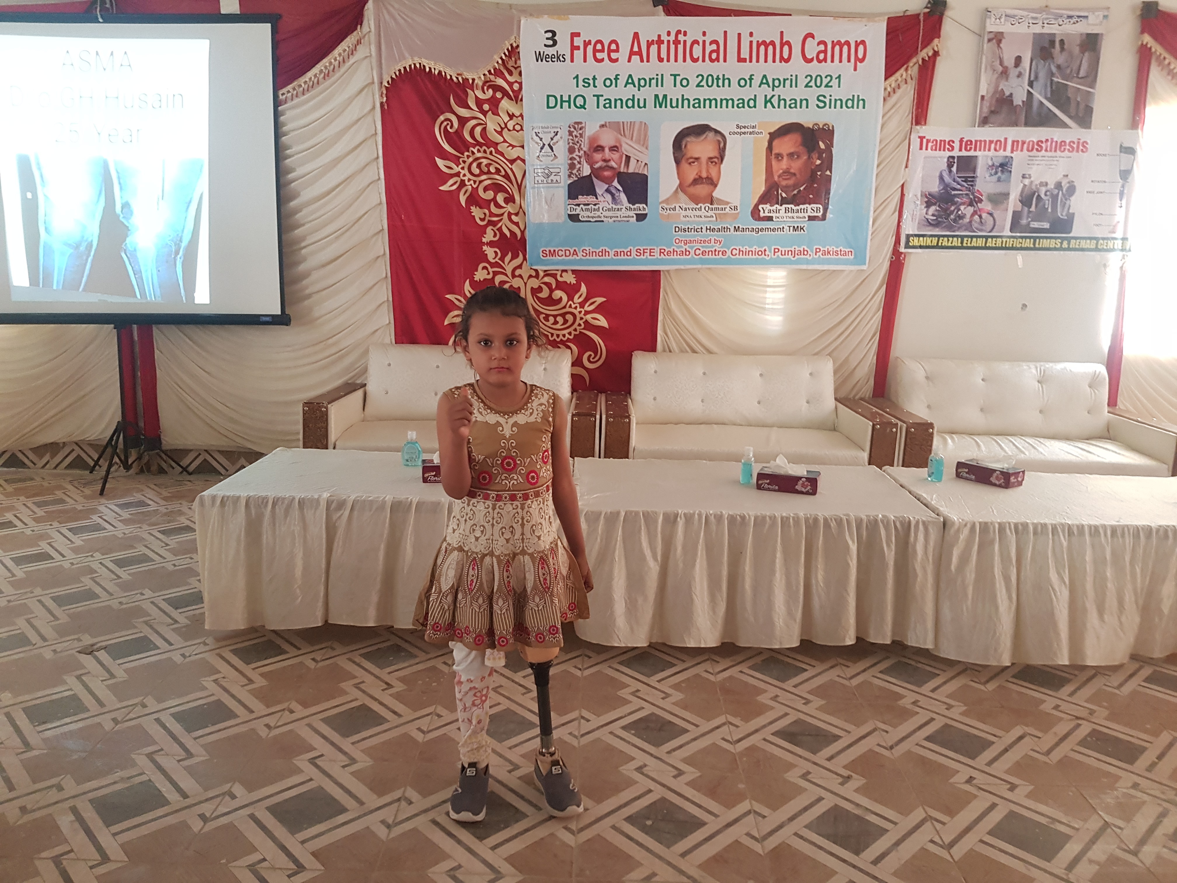 Prosthetic device assembly at camp site