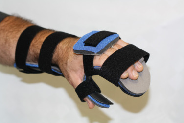 Upper Limb Orthosis