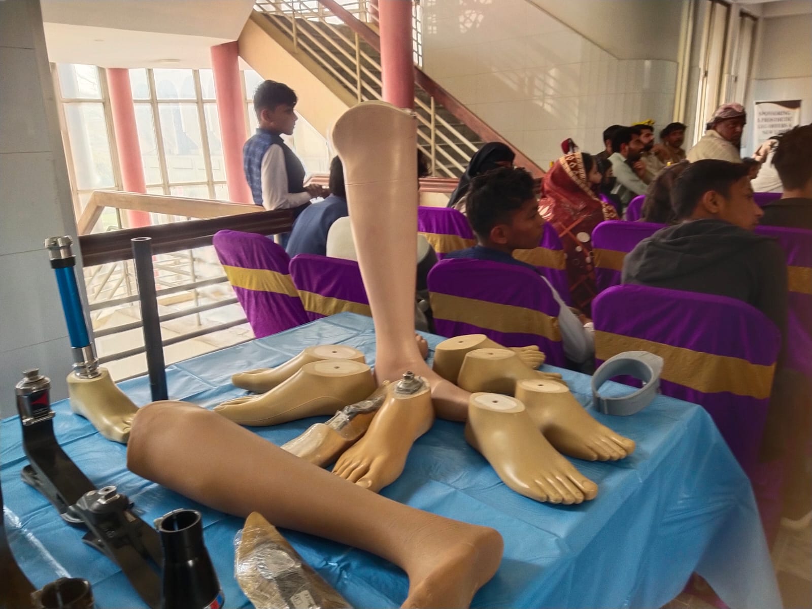 Prosthetic limb fitting